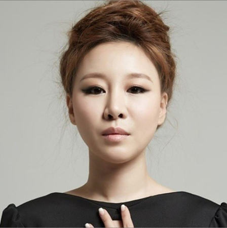 女性歌手ト・ウンヨン、アルバム発売を控え急死…32歳