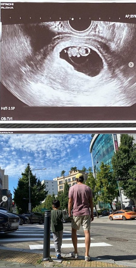 俳優パク・コニョン、2児のパパに！妻の妊娠に感激「待ってるよ」