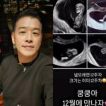 “19歳年下妻が妊娠”俳優リュ・シウォン、12週目になる赤ちゃん“クンクン”の超音波公開